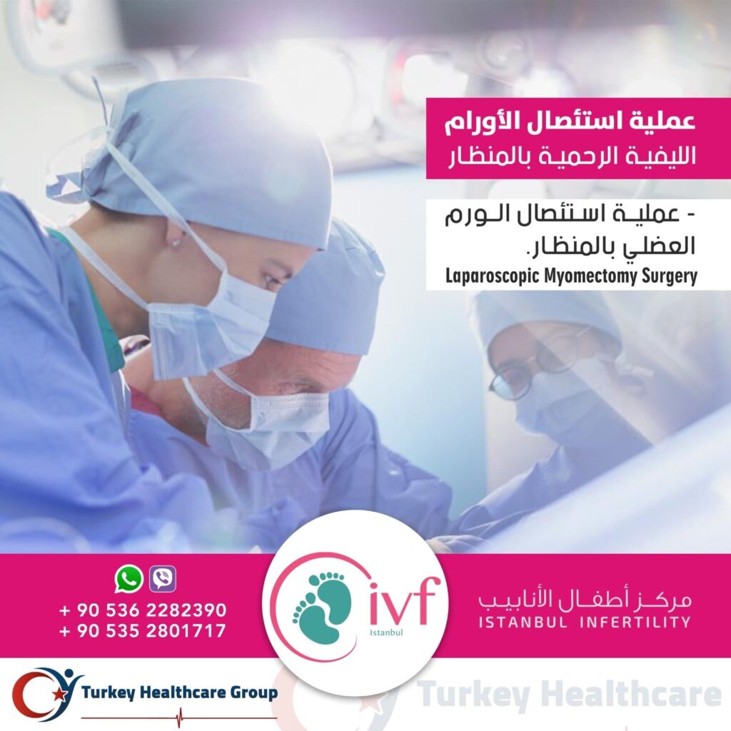 عملية استئصال الورم العضلي بالمنظار