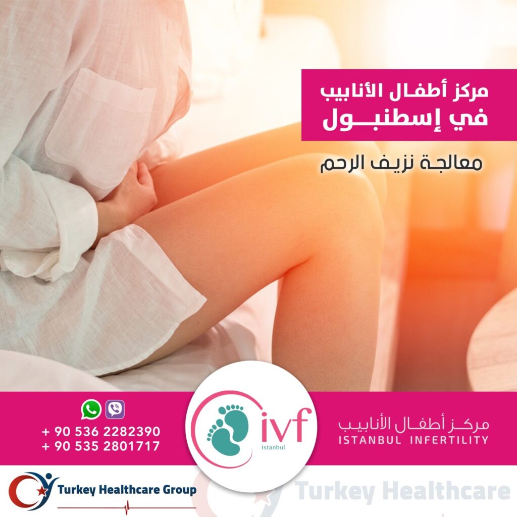 معالجة نزيف الرحم