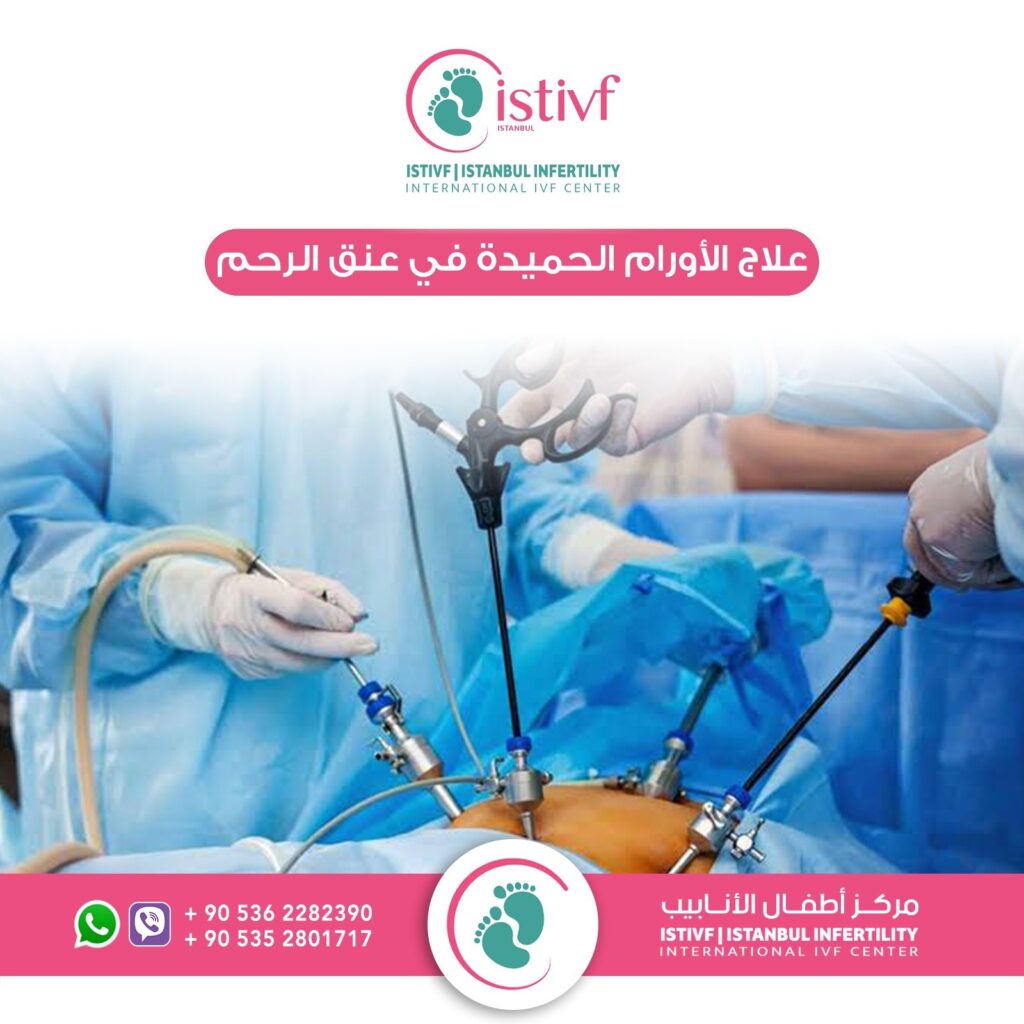 معالجة الاورام الحميدة في عنق الرحم